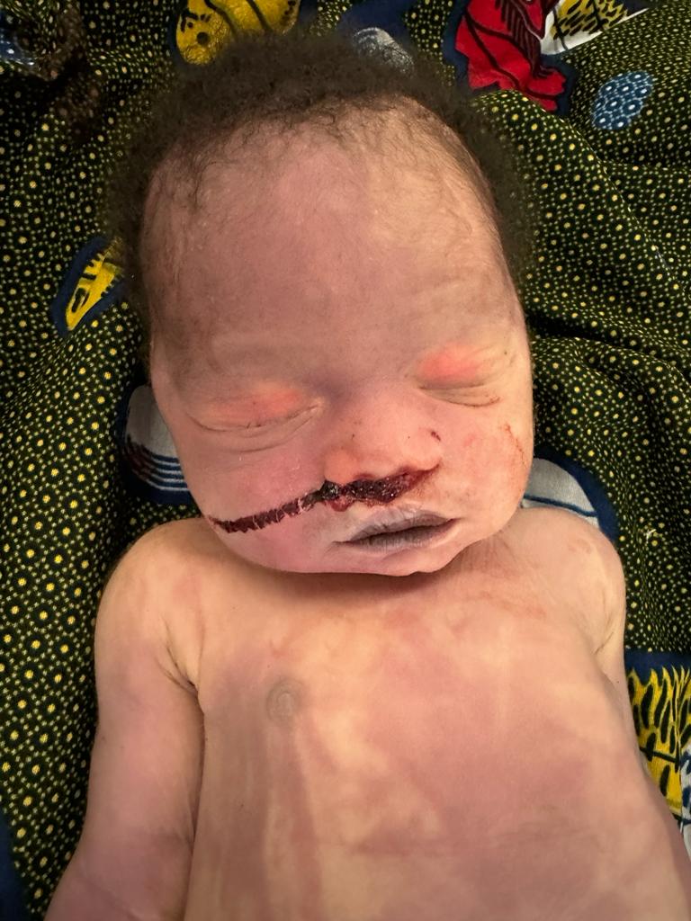 Horreur : une femme empoisonne un bébé de 48h.